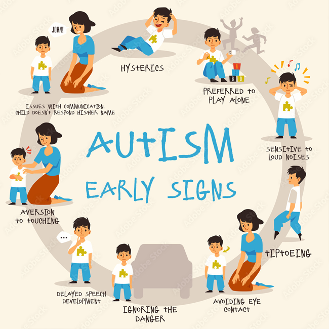 AQ‑J検査イメージ